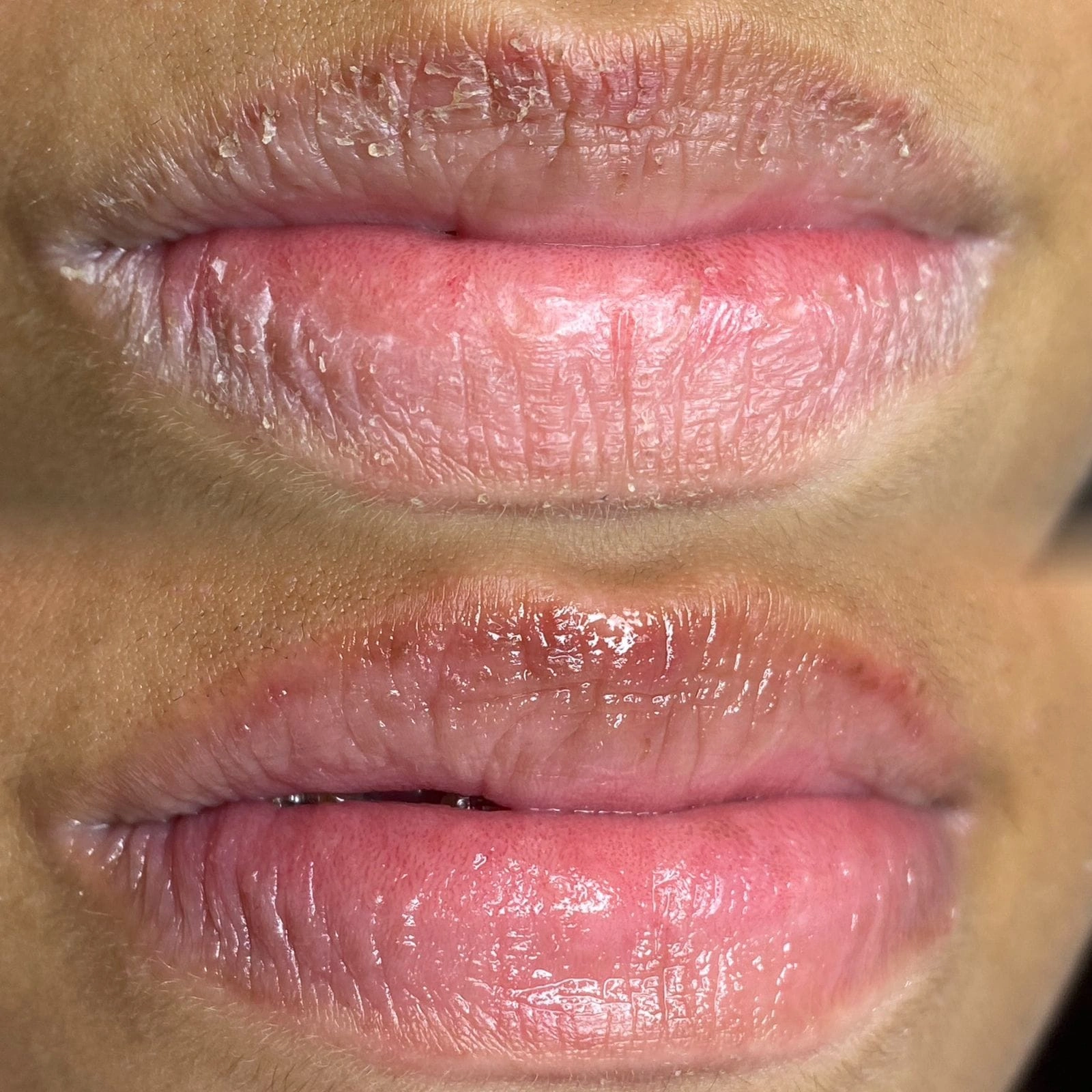 Estética Facial — Studio RR